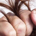 تقصف الشعر وعلاجه