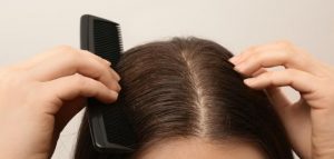طرق لإزالة القشرة من الشعر