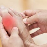 أعراض النقرس